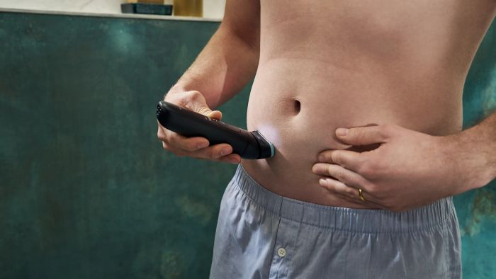 Тример Philips BG7470/15